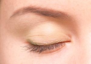 カンジダの予防に効果があるサプリ